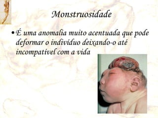 Monstruosidade É uma anomalia muito acentuada que pode deformar o indivíduo deixando-o até incompatível com a vida 