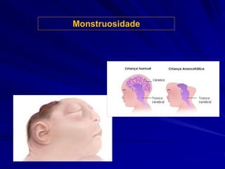 Monstruosidade
 