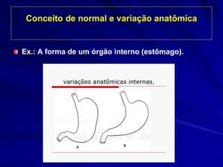 Conceito de normal e variação anatômica
Ex.: A forma de um órgão interno (estômago).
 