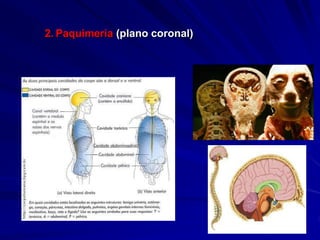 2. Paquimeria (plano coronal)
 