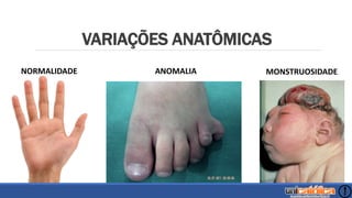 VARIAÇÕES ANATÔMICAS
NORMALIDADE ANOMALIA MONSTRUOSIDADE
 
