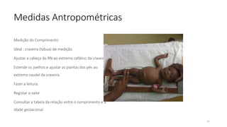 40
Medidas Antropométricas
Medição do Comprimento
Ideal : craveira (tábua) de medição.
Ajustar a cabeça do RN ao extremo cefálico da craveira
Estende os joelhos e ajustar as plantas dos pés ao
extremo caudal da craveira.
Fazer a leitura.
Registar o valor
Consultar a tabela da relação entre o comprimento e a
idade gestacional.
 
