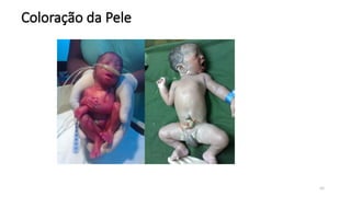 48
Coloração da Pele
 