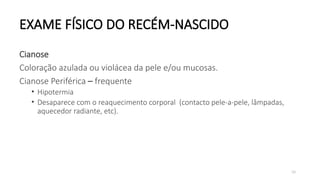 50
EXAME FÍSICO DO RECÉM-NASCIDO
Cianose
Coloração azulada ou violácea da pele e/ou mucosas.
Cianose Periférica – frequente
• Hipotermia
• Desaparece com o reaquecimento corporal (contacto pele-a-pele, lâmpadas,
aquecedor radiante, etc).
 