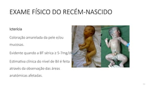 53
EXAME FÍSICO DO RECÉM-NASCIDO
Icterícia
Coloração amarelada da pele e/ou
mucosas.
Evidente quando a BT sérica ≥ 5-7mg/dl.
Estimativa clínica do nível de Bil é feita
através da observação das áreas
anatómicas afetadas.
 