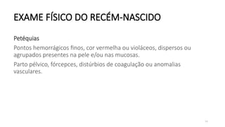 54
EXAME FÍSICO DO RECÉM-NASCIDO
Petéquias
Pontos hemorrágicos finos, cor vermelha ou violáceos, dispersos ou
agrupados presentes na pele e/ou nas mucosas.
Parto pélvico, fórcepces, distúrbios de coagulação ou anomalias
vasculares.
 