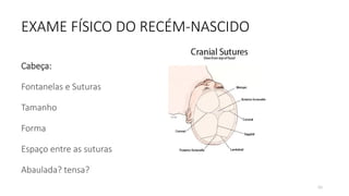 60
EXAME FÍSICO DO RECÉM-NASCIDO
Cabeça:
Fontanelas e Suturas
Tamanho
Forma
Espaço entre as suturas
Abaulada? tensa?
 