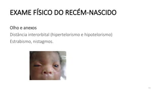 63
EXAME FÍSICO DO RECÉM-NASCIDO
Olho e anexos
Distância interorbital (hipertelorismo e hipotelorismo)
Estrabismo, nistagmos.
 