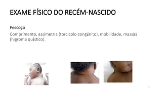 73
EXAME FÍSICO DO RECÉM-NASCIDO
Pescoço
Comprimento, assimetria (torcicolo congénito), mobilidade, massas
(higroma quístico).
 