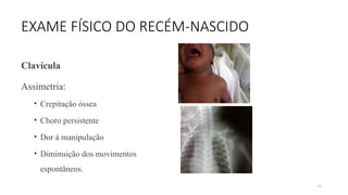 74
EXAME FÍSICO DO RECÉM-NASCIDO
Clavícula
Assimetria:
• Crepitação óssea
• Choro persistente
• Dor á manipulação
• Diminuição dos movimentos
espontâneos.
 