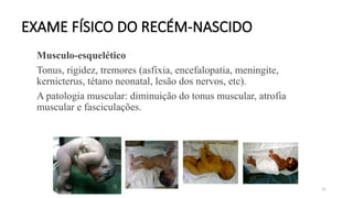 90
EXAME FÍSICO DO RECÉM-NASCIDO
Musculo-esquelético
Tonus, rigidez, tremores (asfixia, encefalopatia, meningite,
kernicterus, tétano neonatal, lesão dos nervos, etc).
A patologia muscular: diminuição do tonus muscular, atrofia
muscular e fasciculações.
 