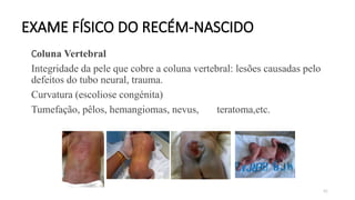 92
EXAME FÍSICO DO RECÉM-NASCIDO
Coluna Vertebral
Integridade da pele que cobre a coluna vertebral: lesões causadas pelo
defeitos do tubo neural, trauma.
Curvatura (escoliose congénita)
Tumefação, pêlos, hemangiomas, nevus, teratoma,etc.
 