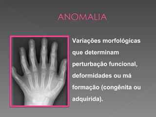 Variações morfológicas
que determinam
perturbação funcional,
deformidades ou má
formação (congênita ou
adquirida).
 