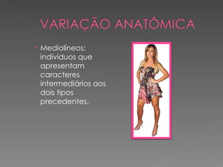 Mediolíneos:
  indivíduos que
  apresentam
  caracteres
  intermediários aos
  dois tipos
  precedentes.
 