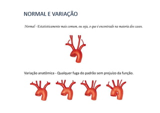 Normal - Estatisticamente mais comum, ou seja, o que é encontrado na maioria dos casos.




Variação anatômica - Qualquer fuga do padrão sem prejuízo da função.
 