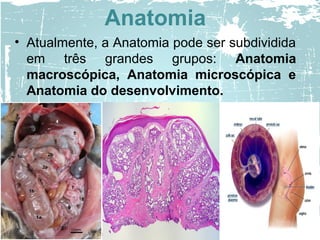 Anatomia
• Atualmente, a Anatomia pode ser subdividida
em três grandes grupos: Anatomia
macroscópica, Anatomia microscópica e
Anatomia do desenvolvimento.
 