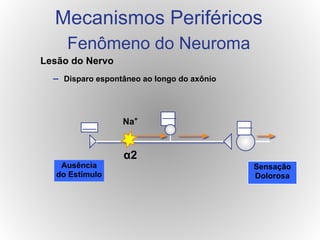 Lesão do Nervo
– Disparo espontâneo ao longo do axônio
Ausência
do Estímulo
Sensação
Dolorosa
Na+
α2
Mecanismos Periféricos
Fenômeno do Neuroma
 