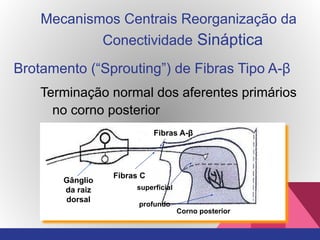 Brotamento (“Sprouting”) de Fibras Tipo A-β
Terminação normal dos aferentes primários
no corno posterior
Gânglio
da raiz
dorsal
Fibras A-β
Fibras C
superficial
profundo
Mecanismos Centrais Reorganização da
Conectividade Sináptica
Corno posterior
 