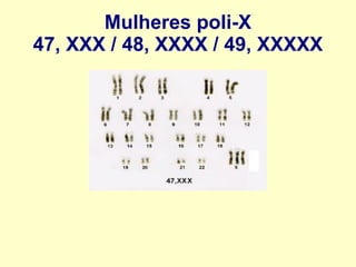 Mulheres poli-X
47, XXX / 48, XXXX / 49, XXXXX
 