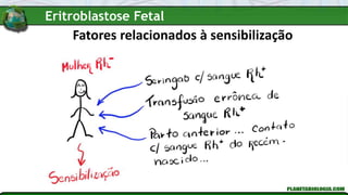 Fatores relacionados à sensibilização
Eritroblastose Fetal
 