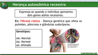 Expressa-se quando o indivíduo apresenta
dois genes alelos recessivos.
Ex: Fibrose cística – Doença genética que afeta os
pulmões, pâncreas e glândulas sudoríparas.
Genótipos:
AA: Normal
Aa: Normal
aa: Afetado
Herança autossômica recessiva
 