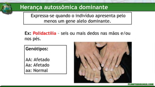 Expressa-se quando o indivíduo apresenta pelo
menos um gene alelo dominante.
Ex: Polidactilia – seis ou mais dedos nas mãos e/ou
nos pés.
Genótipos:
AA: Afetado
Aa: Afetado
aa: Normal
Herança autossômica dominante
 