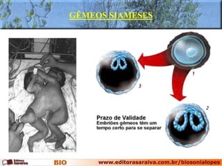 GÊMEOS SIAMESES
 