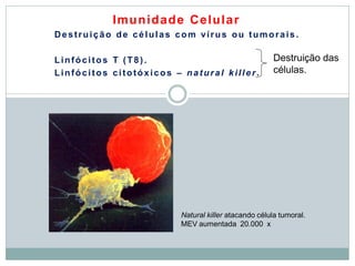 Imunidade Celular
Destruição de células com vírus ou tumorais.
Linfócitos T (T8).
Linfócitos citotóxicos – natural killer.
Destruição das
células.
Natural killer atacando célula tumoral.
MEV aumentada 20.000 x
 
