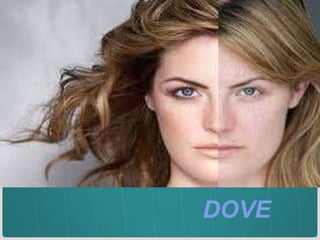 DOVE 