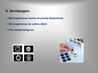 Descobriu a etiologia do Antraz.