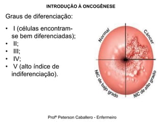 INTRODUÇÃO À ONCOGÊNESE

Graus de diferenciação:
• I (células encontram-
  se bem diferenciadas);
• II;
• III;
• IV;
• V (alto índice de
  indiferenciação).




              Profº Peterson Caballero - Enfermeiro
 