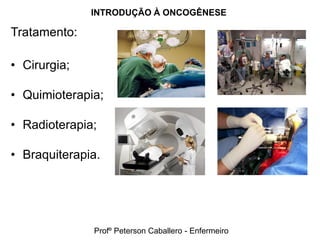 INTRODUÇÃO À ONCOGÊNESE

Tratamento:

• Cirurgia;

• Quimioterapia;

• Radioterapia;

• Braquiterapia.




              Profº Peterson Caballero - Enfermeiro
 