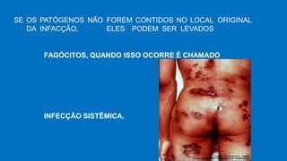 SE OS PATÓGENOS NÃO FOREM CONTIDOS NO LOCAL ORIGINAL
DA INFACÇÃO, ELES PODEM SER LEVADOS
FAGÓCITOS, QUANDO ISSO OCORRE É CHAMADO
INFECÇÃO SISTÊMICA.
 