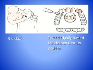 9 o ̓clock Turned slightly toward
the clinician Chin-Up
position
 