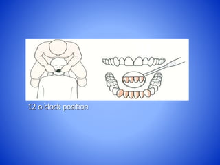 12 o ̓clock position
 