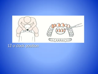 12 o ̓clock position
 