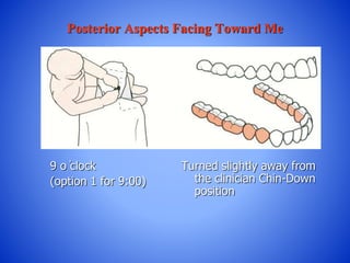 Posterior Aspects Facing Toward Me
9 o ̓clock
(option 1 for 9:00)
Turned slightly away from
the clinician Chin-Down
position
 