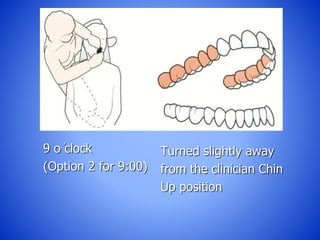 9 o ̓clock
(Option 2 for 9:00)
Turned slightly away
from the clinician Chin
Up position
 