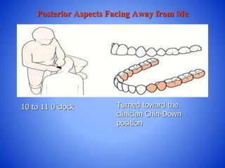 Posterior Aspects Facing Away from Me
10 to 11 0 ̓clock Turned toward the
clinician Chin-Down
position
 