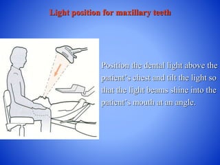 Light position for maxillary teeth
Position the dental light above the
patient’s chest and tilt the light so
that the light beams shine into the
patient’s mouth at an angle.
 