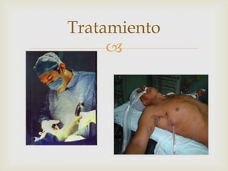 Tratamiento
     
 