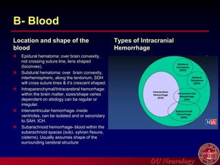 OU Neurology
B- Blood
Location and shape of the
blood
 Epidural hematoma: over brain convexity,
not crossing suture line, lens shaped
(biconvex).
 Subdural hematoma: over brain convexity,
interhemispheric, along the tentorium, SDH
will cross suture lines & it’s crescent shaped.
 Intraparenchymal/Intracerebral hemorrhage:
within the brain matter, sizes/shape varies
dependent on etiology can be regular or
irregular.
 Interventricular hemorrhage- inside
ventricles, can be isolated and or secondary
to SAH, ICH.
 Subarachnoid hemorrhage- blood within the
subarachnoid spaces (sulci, sylvian fissure,
cisterns). Usually assumes shape of the
surrounding cerebral structure
Types of Intracranial
Hemorrhage
 