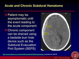 OU Neurology
Acute and Chronic Subdural Hematoma
 Patient may be
asymptomatic until
the event leading to
the acute component
 Chronic component
can be drained using
a bedside burr hole
device such as the
Subdural Evacuation
Port System (SEPS)
http://www.hakeem-sy.com/main/files/subdural%20hematoma.jpg, accessed on 3/31/10
 
