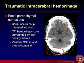 OU Neurology
Traumatic Intracerebral hemorrhage
 Focal parenchymal
contusions
Coup, contra coup,
intermediate coup
CT: hemorrhagic core
surrounded by low
density edema
Variable CBF in and
around contusion
 