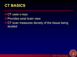 OU Neurology
CT BASICS
 CT uses x-rays
 Provides axial brain view
 CT scan measures density of the tissue being
studied
 