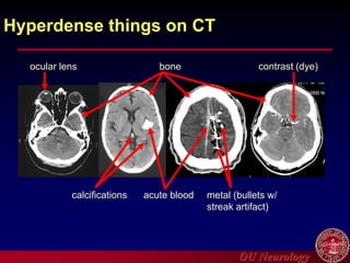 OU Neurology
Hyperdense things on CT
acute blood
ocular lens
calcifications
contrast (dye)
bone
metal (bullets w/
streak artifact)
 