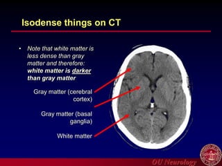 OU Neurology
Isodense things on CT
• Note that white matter is
less dense than gray
matter and therefore:
white matter is darker
than gray matter
Gray matter (cerebral
cortex)
Gray matter (basal
ganglia)
White matter
 