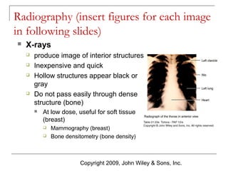 Radiography (insert figures for each image
in following slides)


X-rays






produce image of interior structures
Inexpensive and quick
Hollow structures appear black or
gray
Do not pass easily through dense
structure (bone)


At low dose, useful for soft tissue
(breast)



Mammography (breast)
Bone densitometry (bone density)

Copyright 2009, John Wiley & Sons, Inc.

 