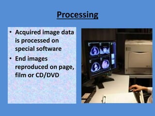 Processing
• Acquired image data
is processed on
special software
• End images
reproduced on page,
film or CD/DVD
 