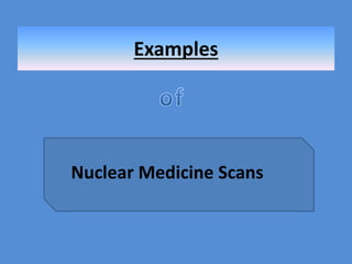 Examples
Nuclear Medicine Scans
 